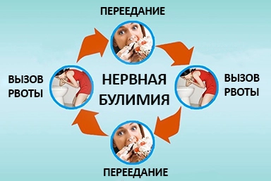 Лечение булимии в Черкесске